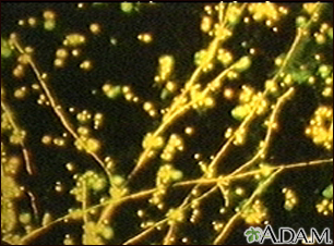 Candida, fluorescent stain