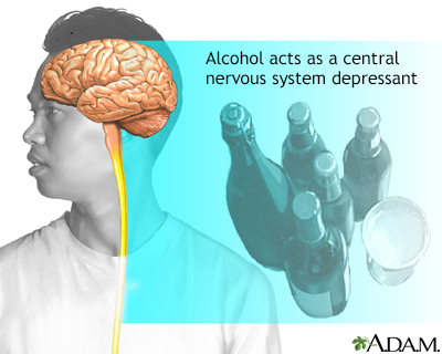 Alcoholism