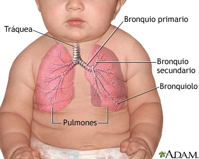 Enfermedad pulmonar hipoxémica neonatal (enfermedad de membrana hialina, aspiración de meconio, neumonía, sepsis, hernia diaf